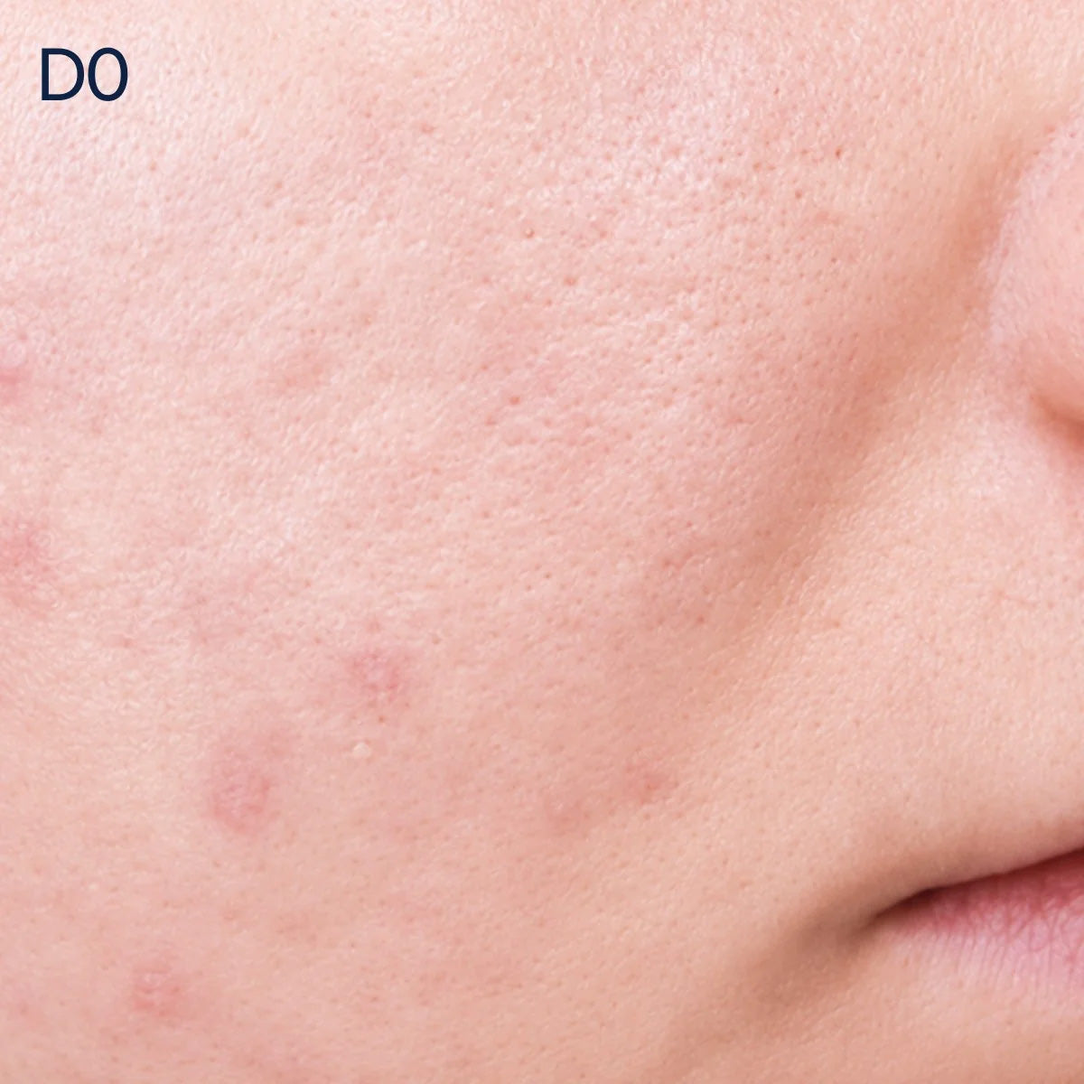 Biologique Recherche Serum Vivant